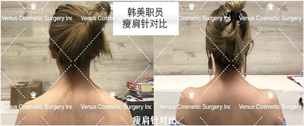 韓美明星整型中心 图片 7