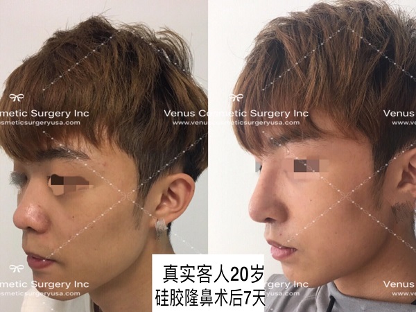 韓美明星整型中心 图片 4