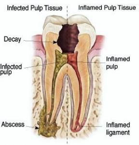 梁家豪牙科根管治療專科 图片 3