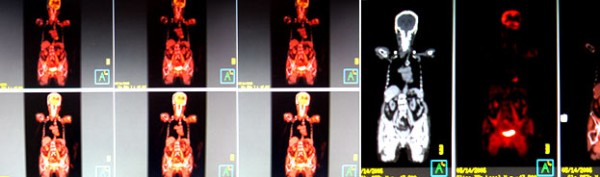 亞太掃描及癌症治療中心─趙智平醫學博士 图片 2