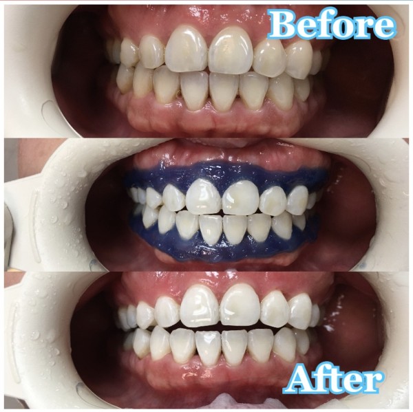 美國牙科學院─胡凌雲醫師 图片 7