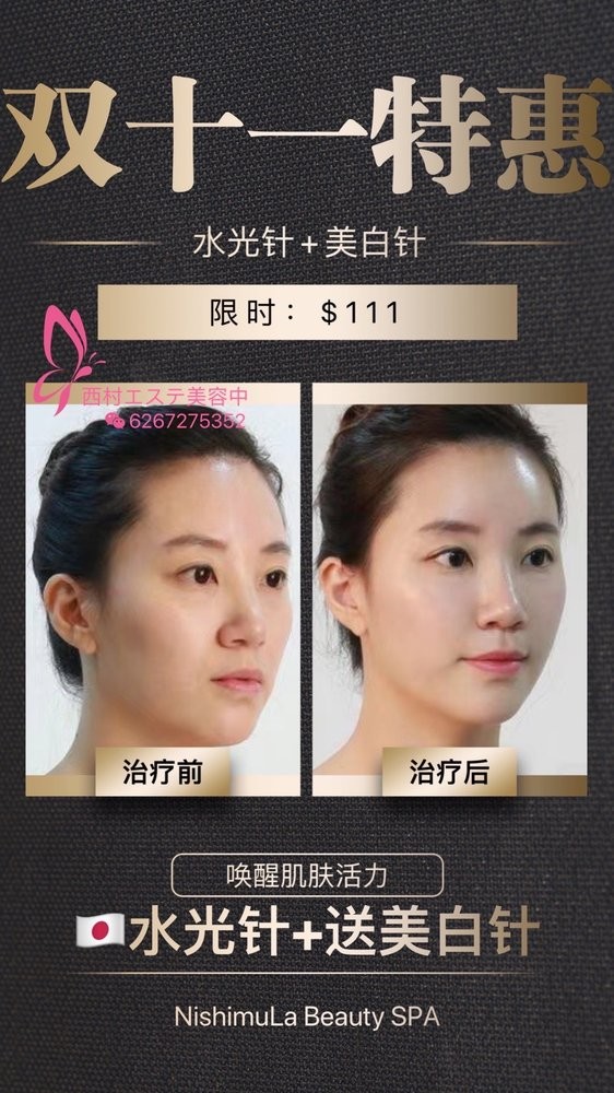 Nishimula Medical Spa 图片 7