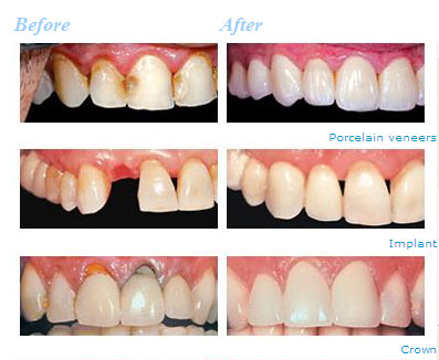 毛有群牙醫博士 图片 3