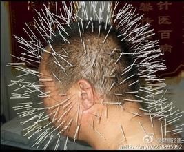 湖南中医针灸减肥知识系统培训班 图片 4