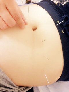 炎黃中醫 图片 4