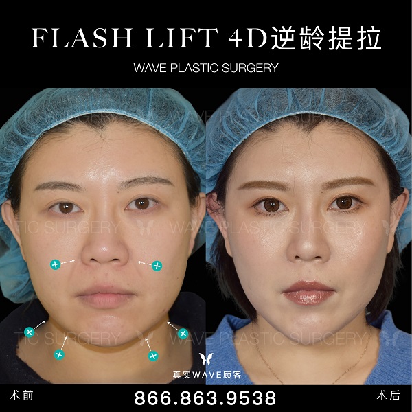 WAVE美亦恆整型外科 图片 4