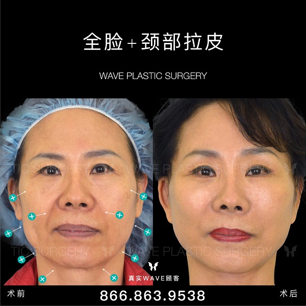 WAVE美亦恆整型外科 图片 5