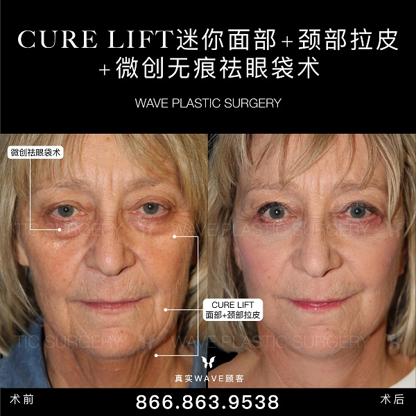 WAVE美亦恆整型外科 图片 8