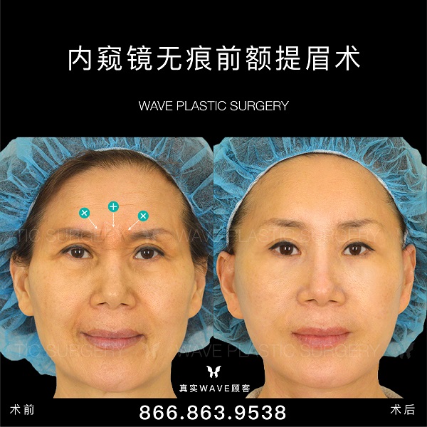 WAVE美亦恆整型外科 图片 7