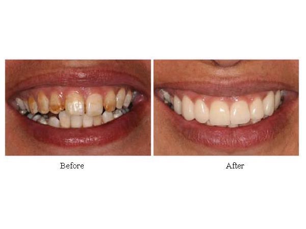 歡欣牙科植牙中心─陳建和牙醫博士