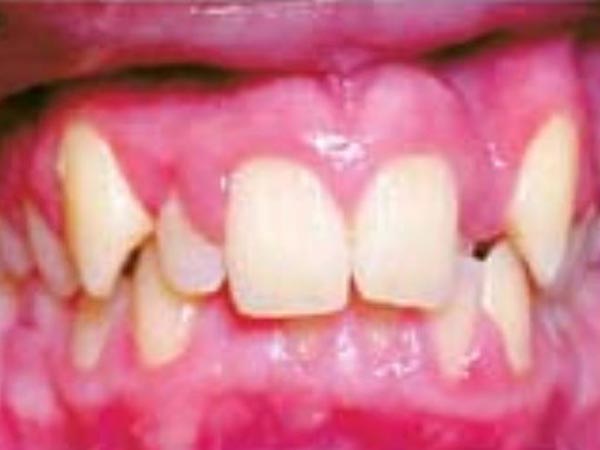 曾文通牙醫博士─第一牙齒矯正診所